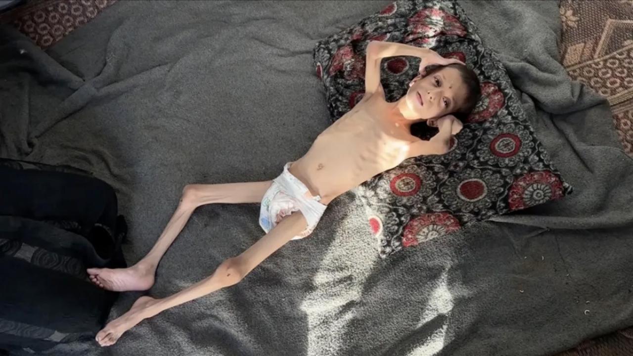 10 yasindaki gazzeli nafiz 4 aylik bebege donustu annesi tasimaya bile korkuyor 58XbZrxv